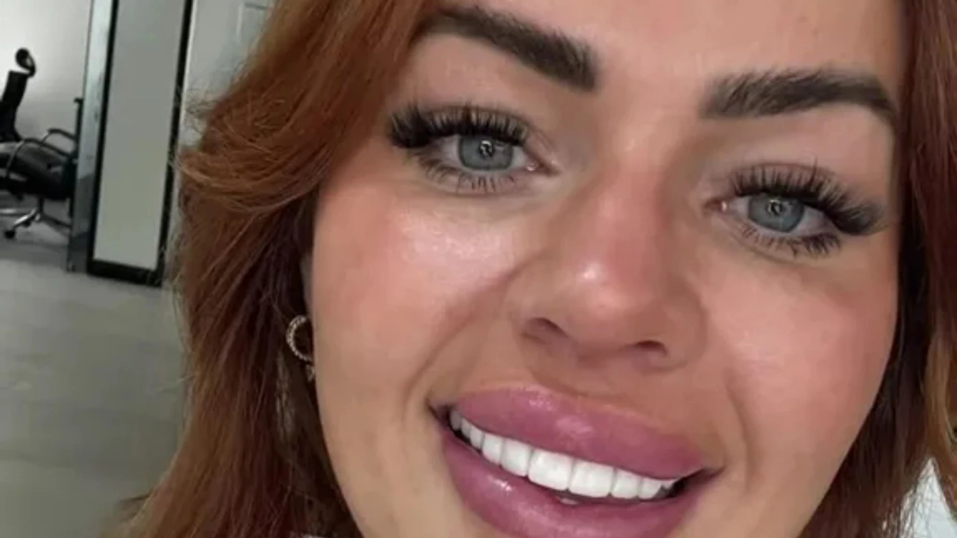 I forked out for a Turkey smile, but people say I had 'amazing teeth' before
