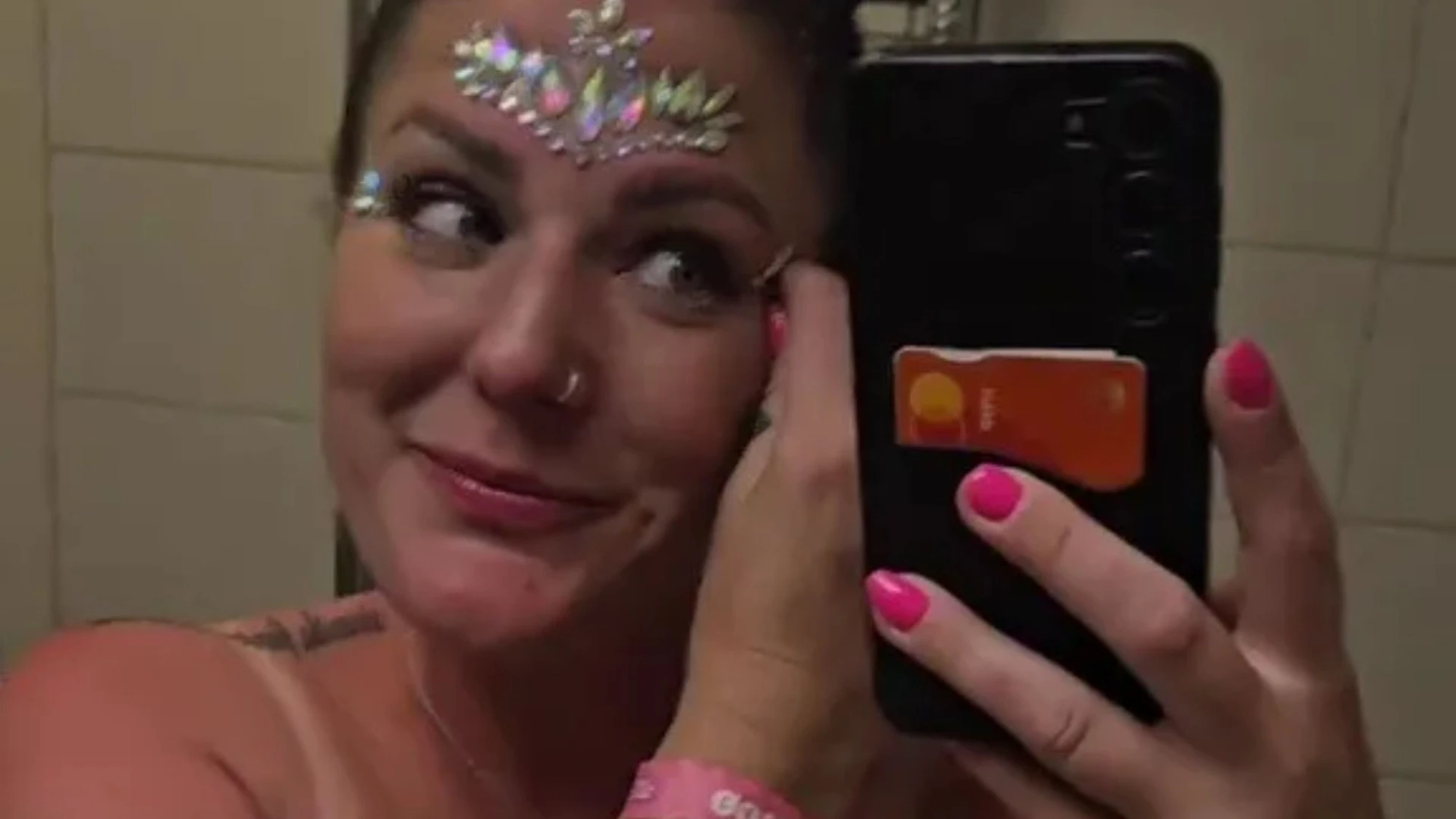 Mum who went to festival shows side effect of wearing face gems in the sun