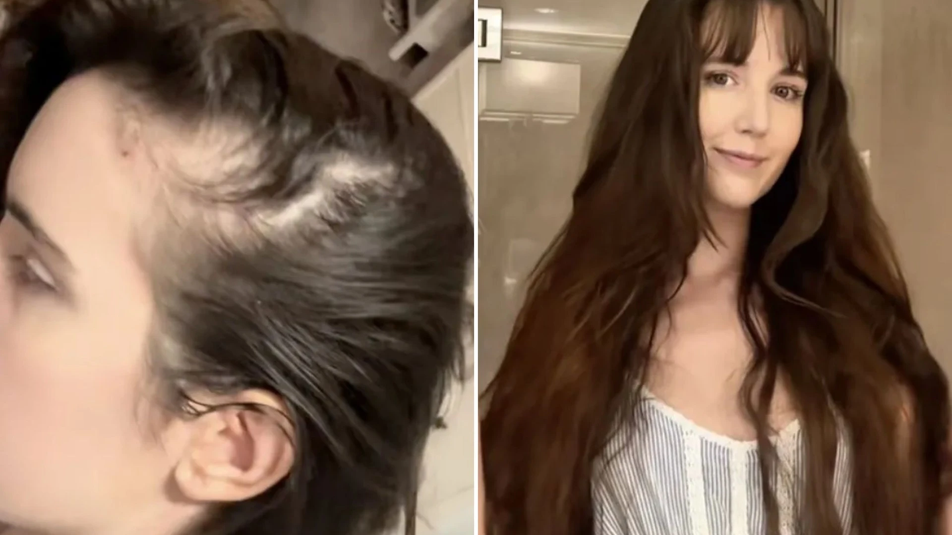 I had bald patches at 21 & tried all the hacks - a viral Amazon buy reversed it