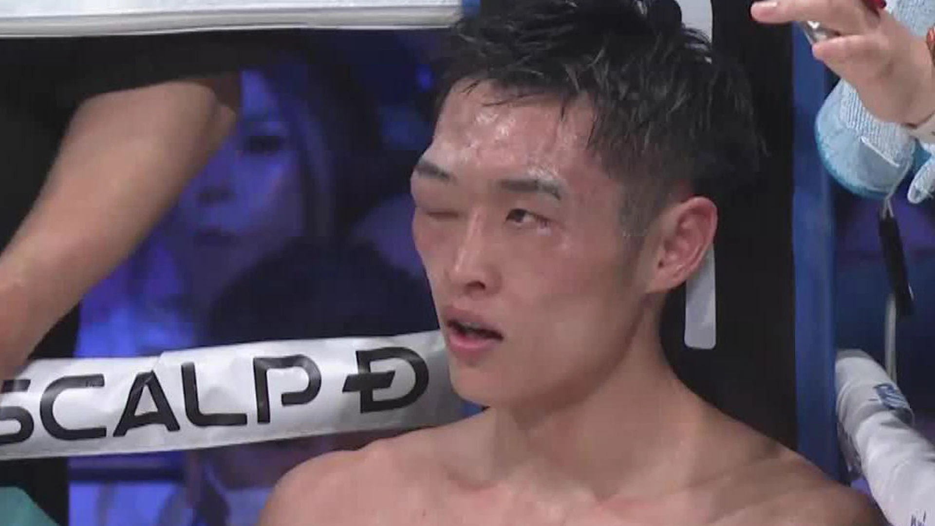 Boxer pulled out of title fight after suffering grotesquely swollen eye