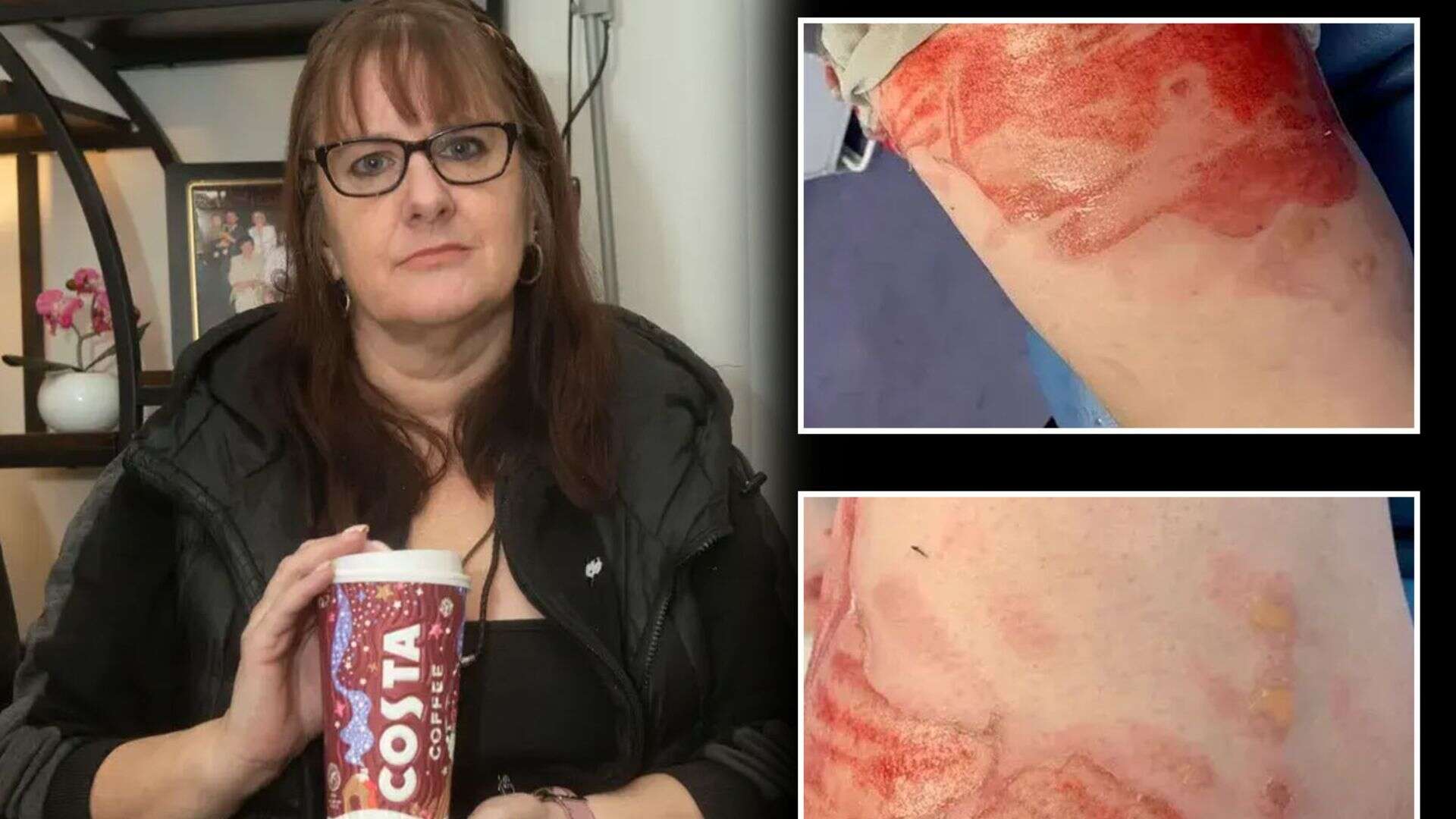 Mum 'scarred for life' by boiling hot drink to sue coffee giant Costa