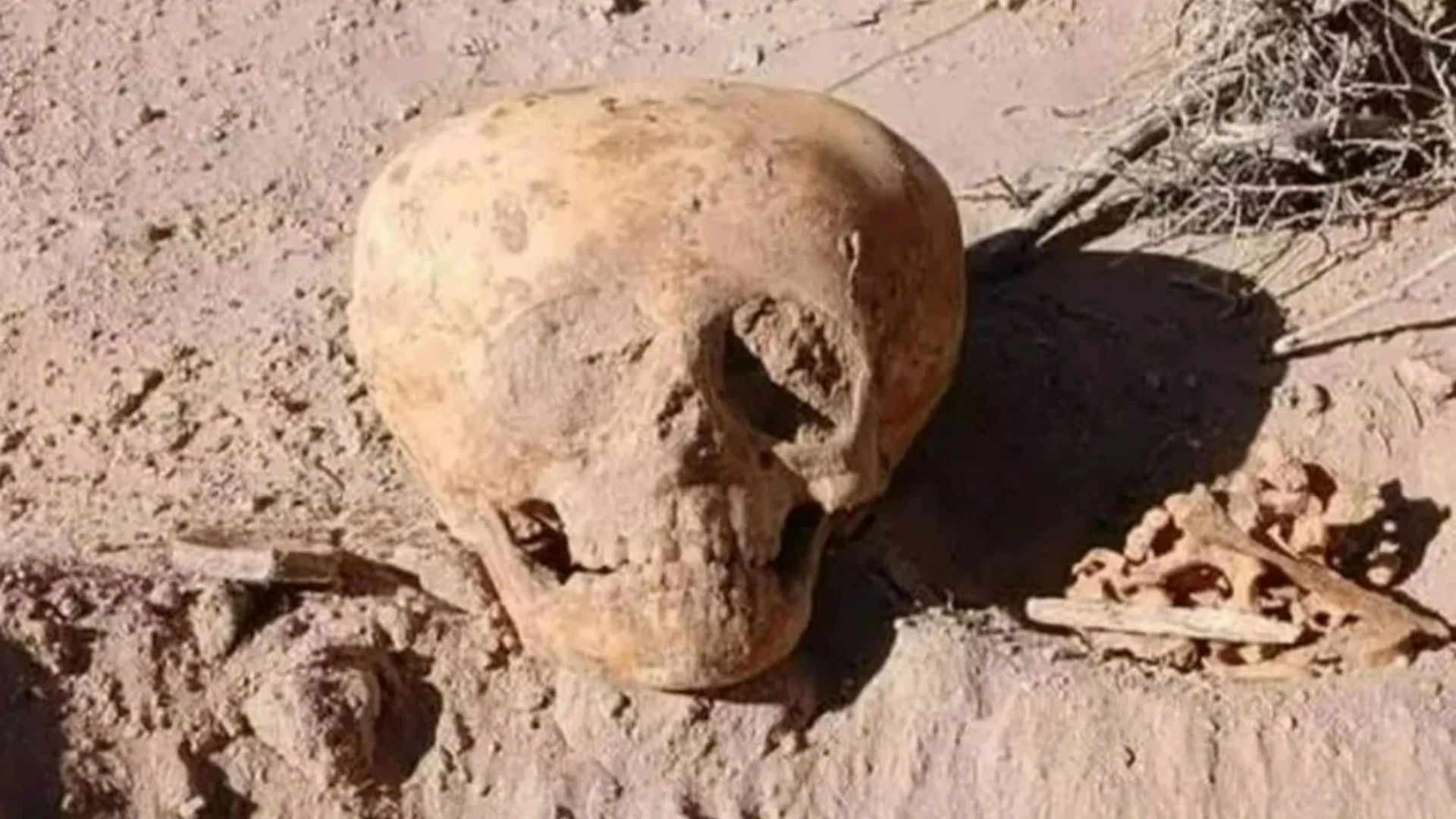 Disturbing alien-like deformed SKULL belonging to 'archaic' human stuns experts