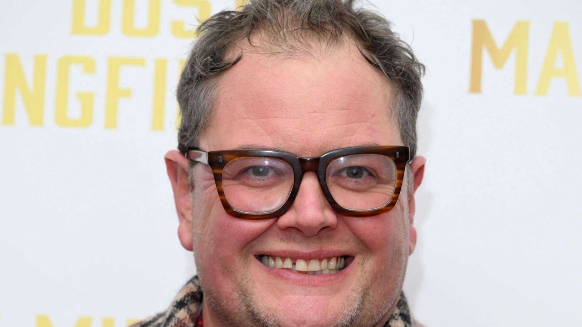 Alan Carr reveals he’s losing his sight and needs terrifying procedure