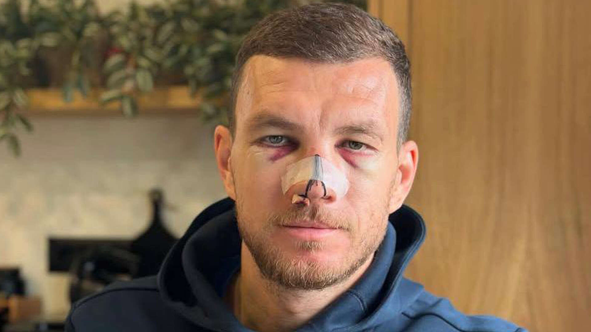 Former Prem star barely recognisable as he shows off horror injuries