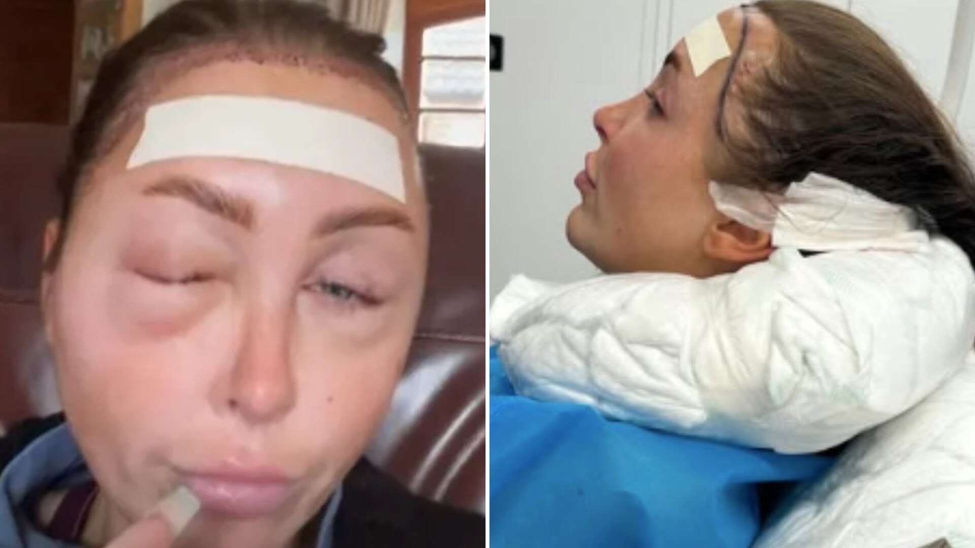 Ella Morgan unrecognisable with VERY swollen face after surgery