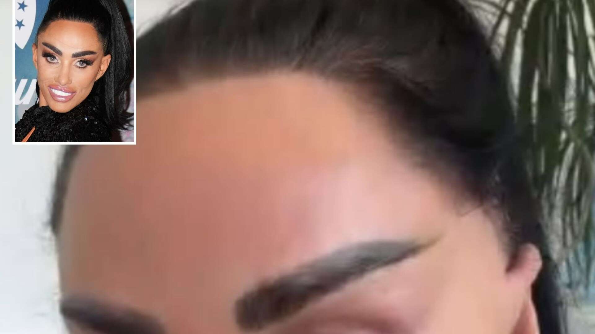 Katie Price reveals new pinned back ears after jetting to Turkey for MORE surgery