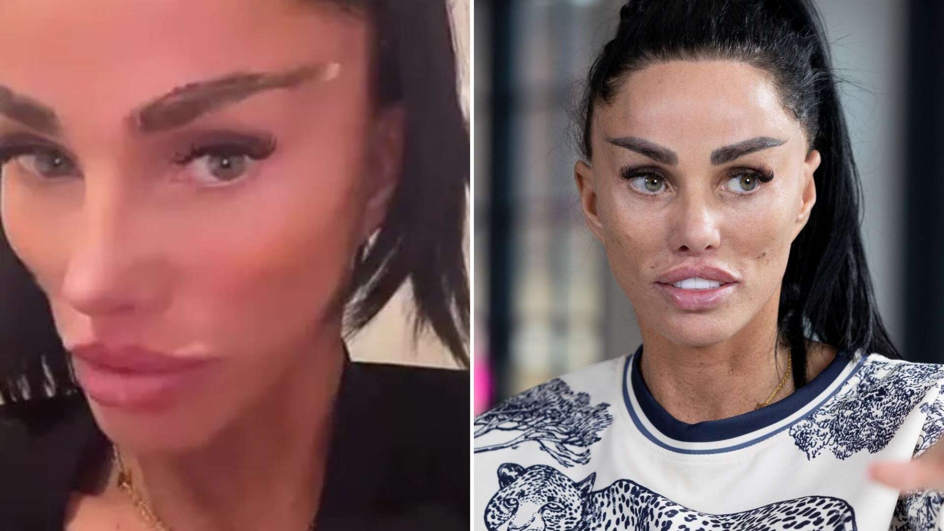 Katie Price reveals eyebrows are peeling OFF after getting them lasered