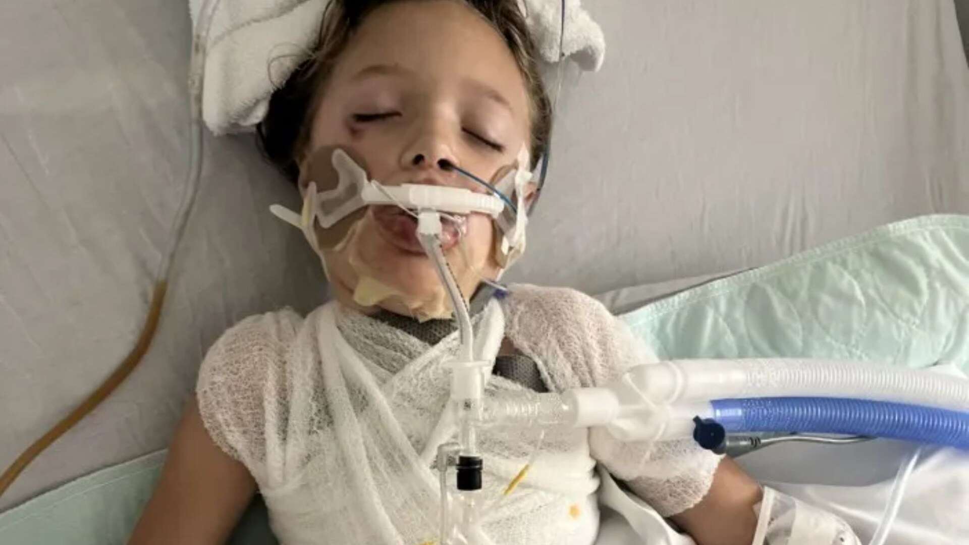 My girl was left in a coma by a stupid squishy toy TikTok trend