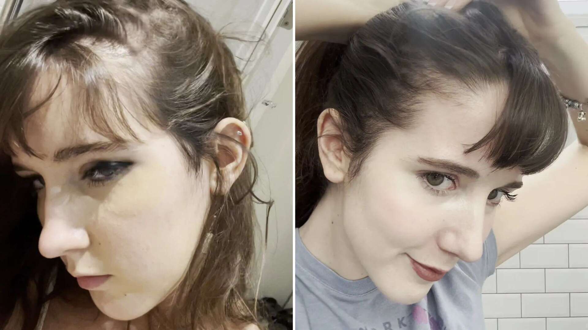 My hair was so thin you could see my scalp - a £4 Amazon buy transformed it