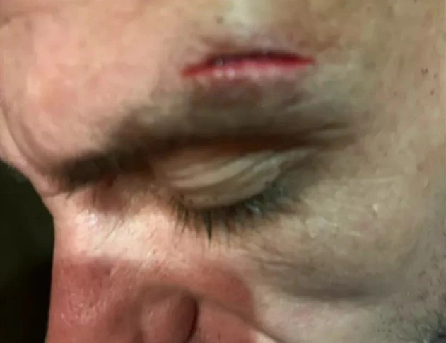 Brit dad was 'beaten up twice in hotel' in front of children during Turkish hols