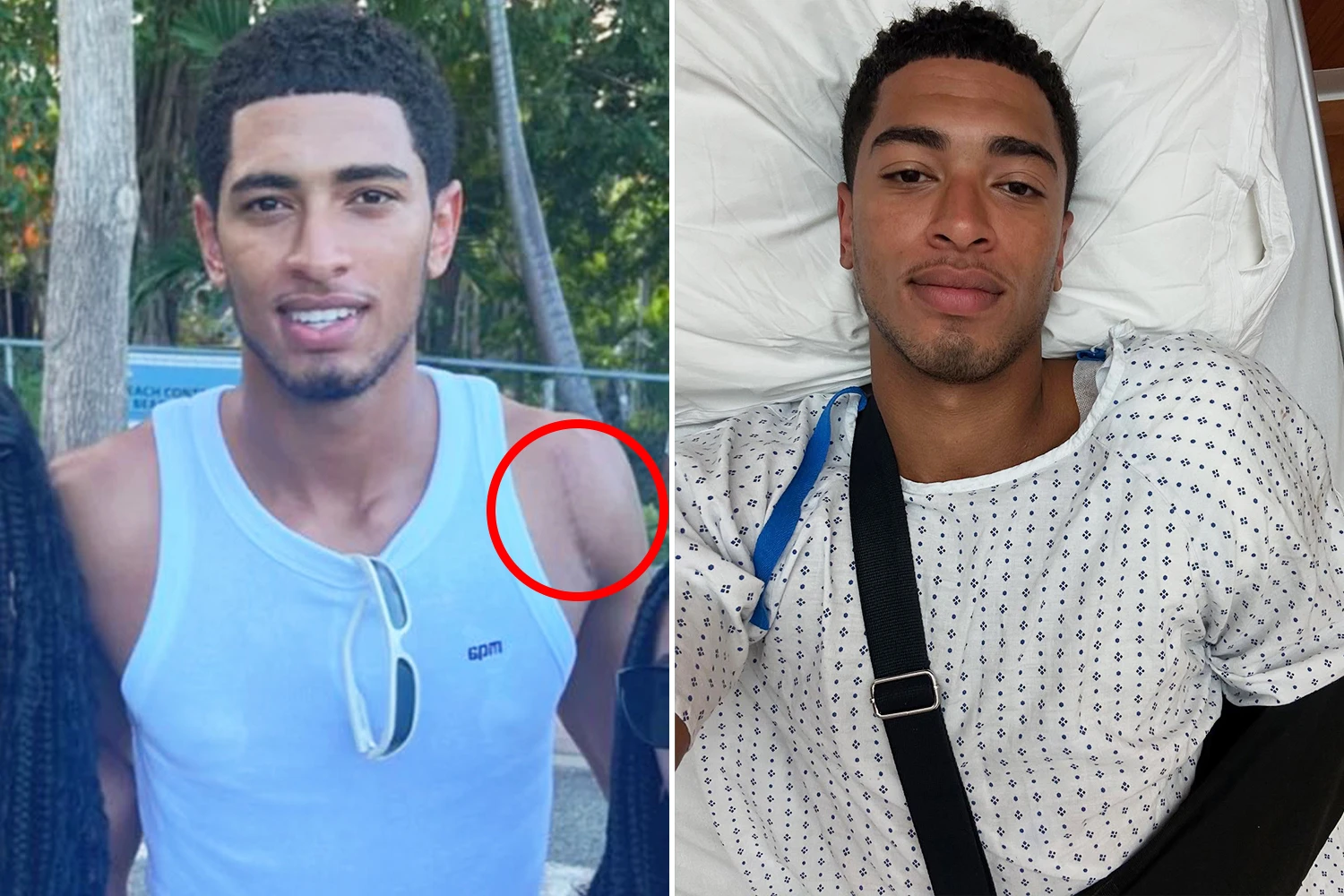 Jude Bellingham shows off huge scar after Real Madrid star's shoulder surgery
