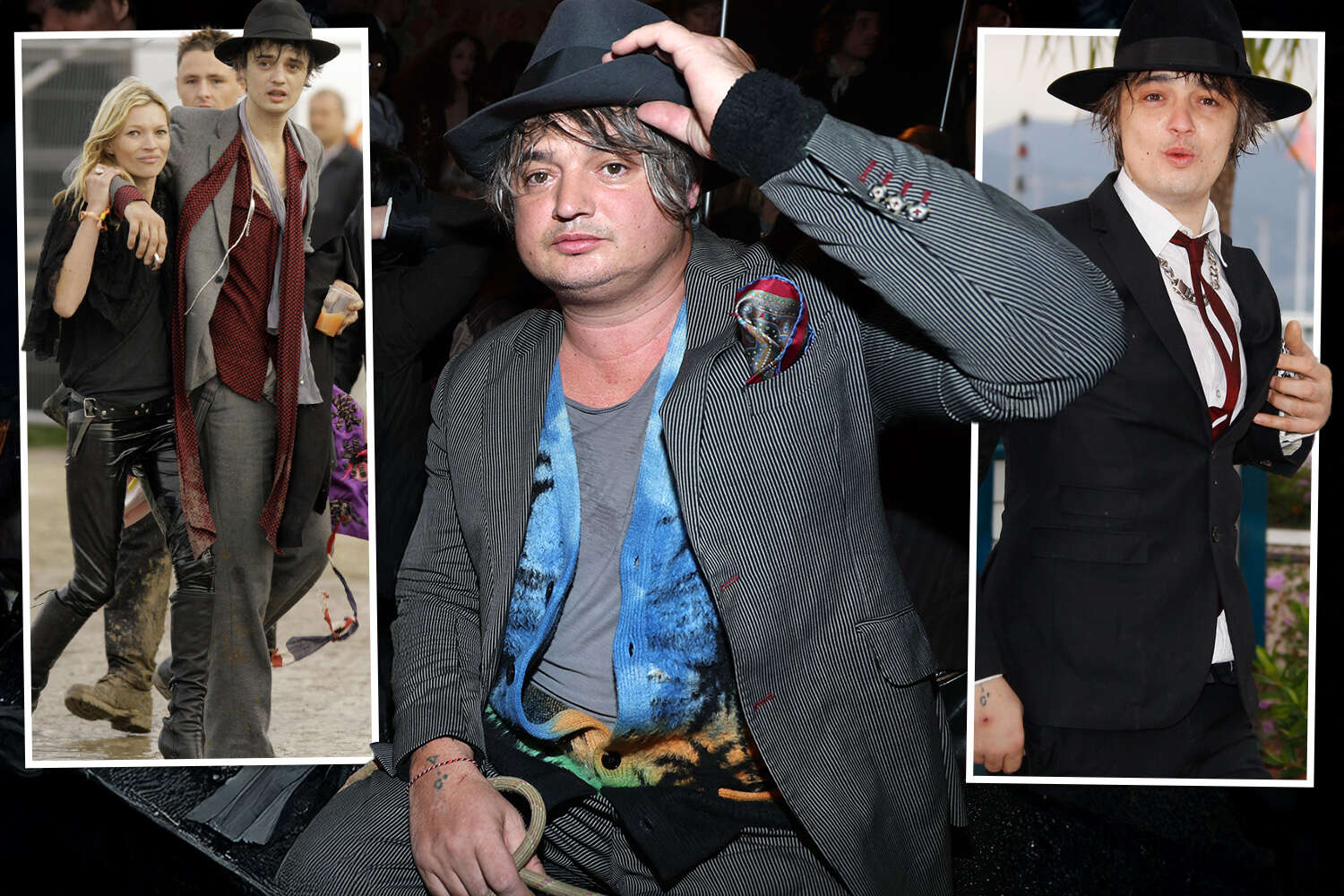 Pete Doherty may need body part amputated amid Type 2 diabetes battle