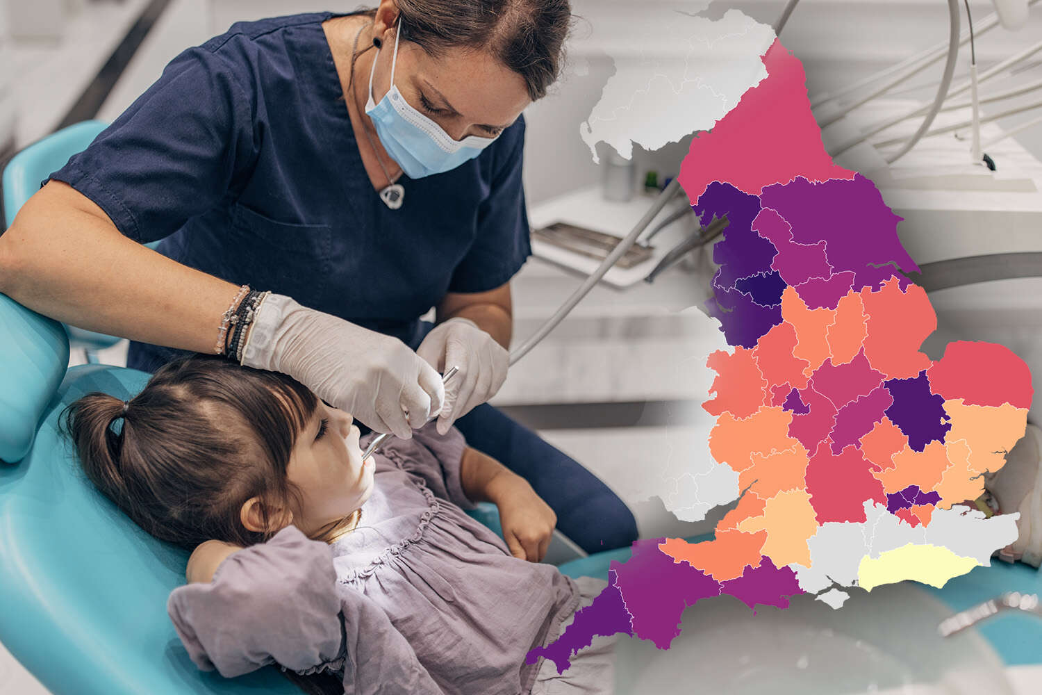 Map reveals where in the country kids are most likely to have rotting teeth