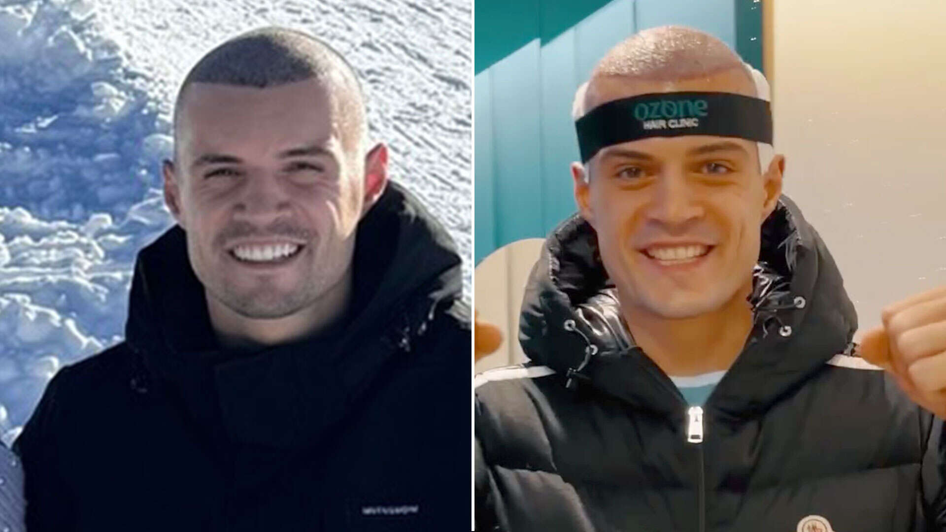 Xhaka reveals reason for dramatic new look as ace undergoes hair transplant