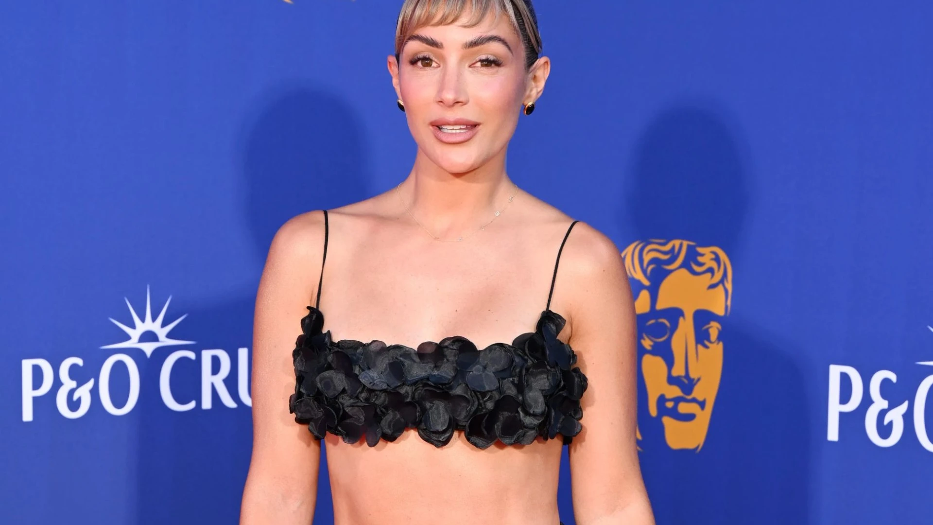 Frankie Bridge reveals full list of work she’s had done from Botox to fillers
