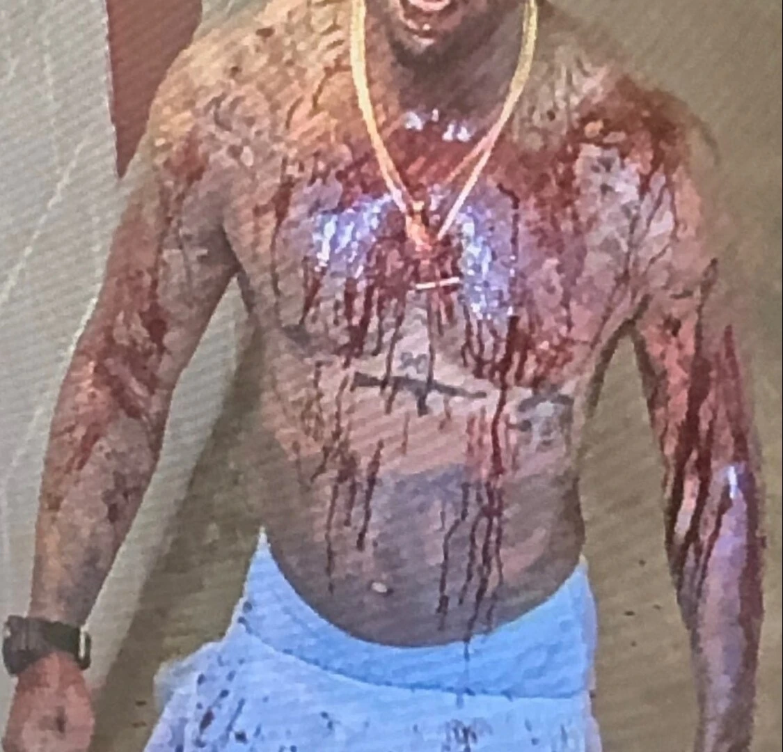 Megan Thee Stallion's shooter seen bloodied after being stabbed in prison