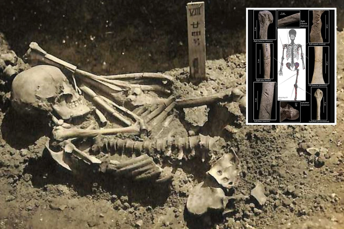 Skeleton of oldest SHARK victim with missing leg found after 3,000 years