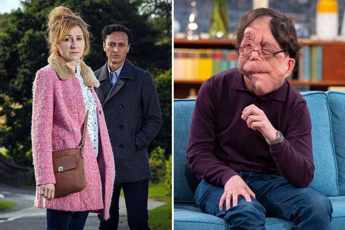 DEVASTATING Emmerdale criticised by disability campaigner over Down's termination storyline