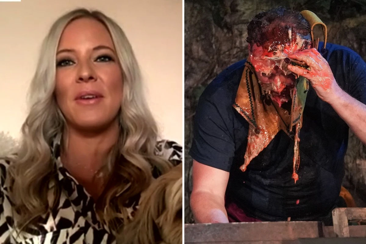 TOO-TH MUCH I'm A Celeb's Russell Watson's wife Louise left 'worried' after he chips tooth
