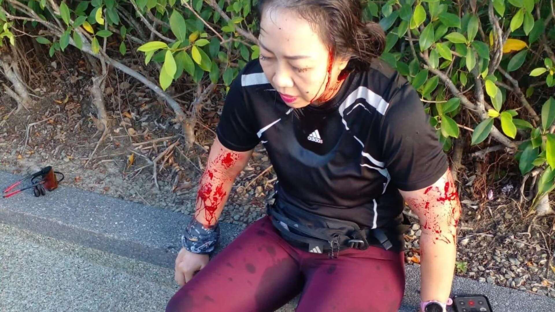 Jogger attacked by rampaging OTTERS as pics show her covered in bite marks