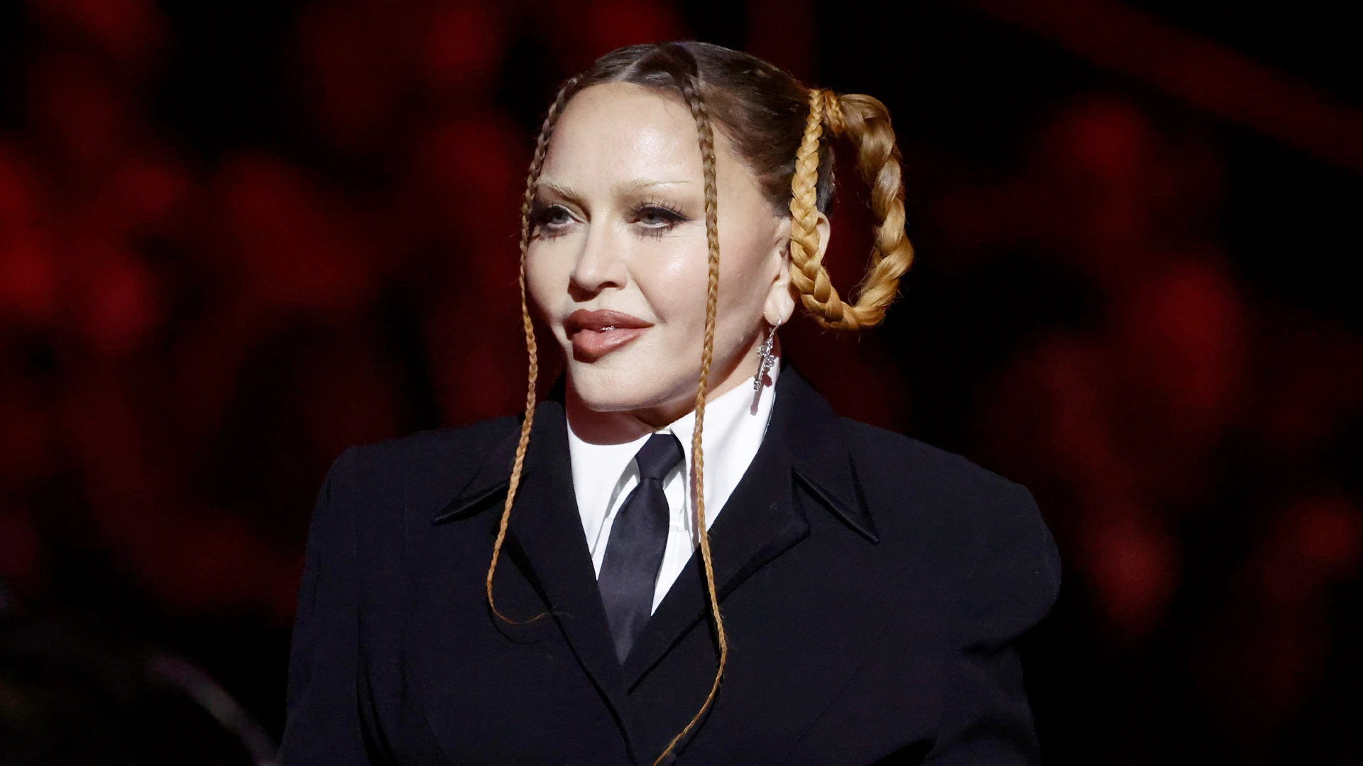 Worst celeb botched injections - including A-lister with 'spocking' in face