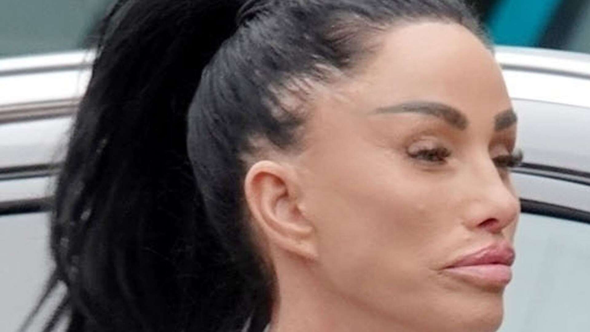 Katie Price shows off stretched £10k facelift so tight it looks PAINFUL