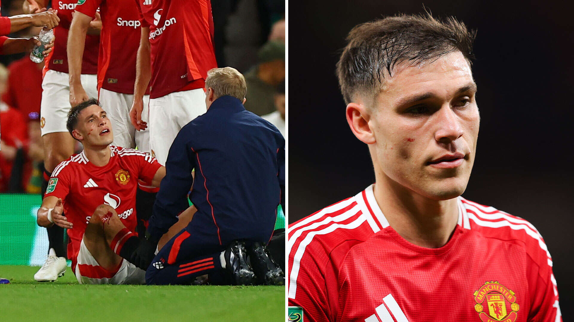 Man Utd fans say Ugarte 'might be him' after playing on covered in blood