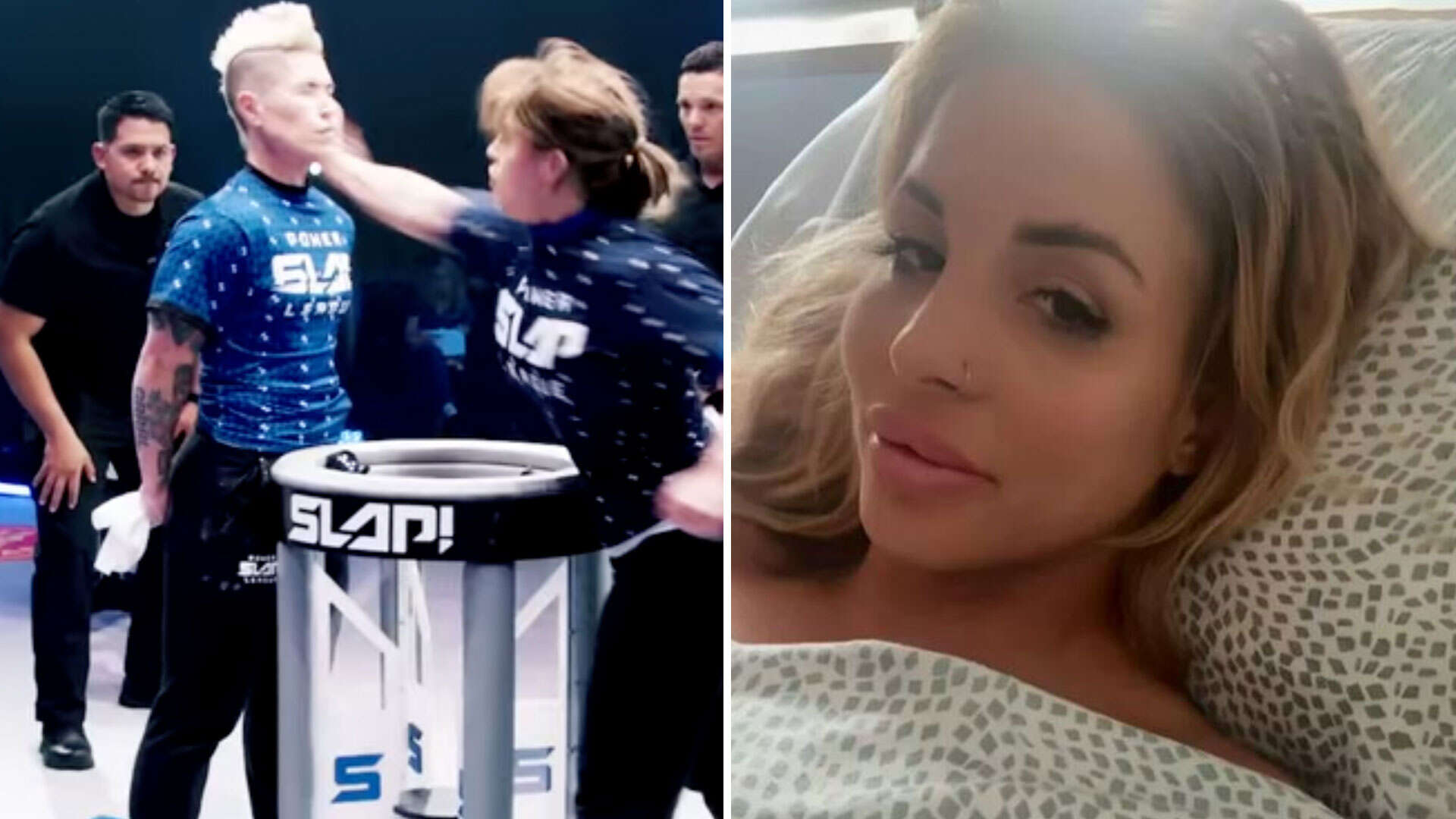 Glam star dubbed 'Taylor Swift of Power Slap' suffers horror injury