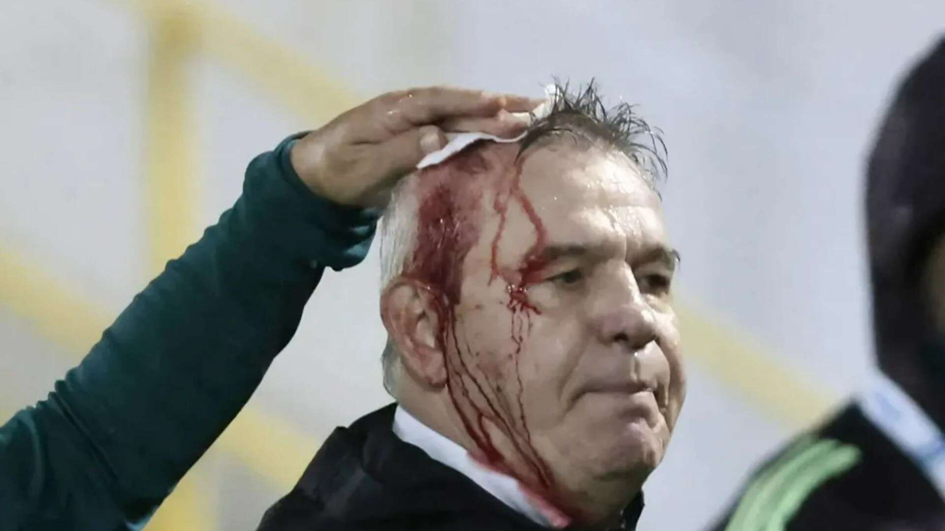 Honduras punished after Mexico coach left with blood pouring down face