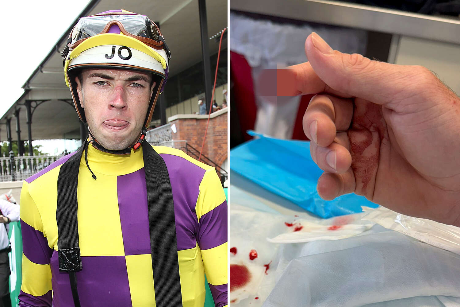 'It won't go back on' - Horse bites off tip of jockey's finger in fit of rage