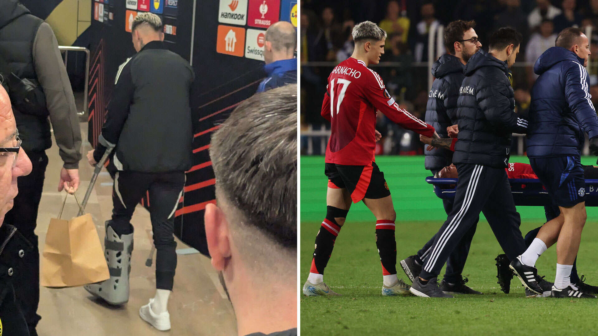 Antony leaves Fenerbahce on crutches after Man Utd star injured