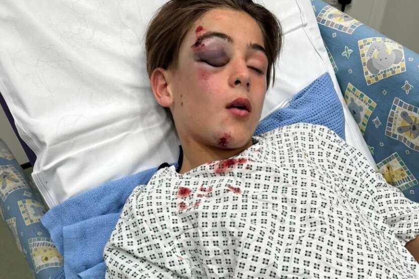 I'm sharing upsetting pic of son after driver ploughed into him 'in revenge'