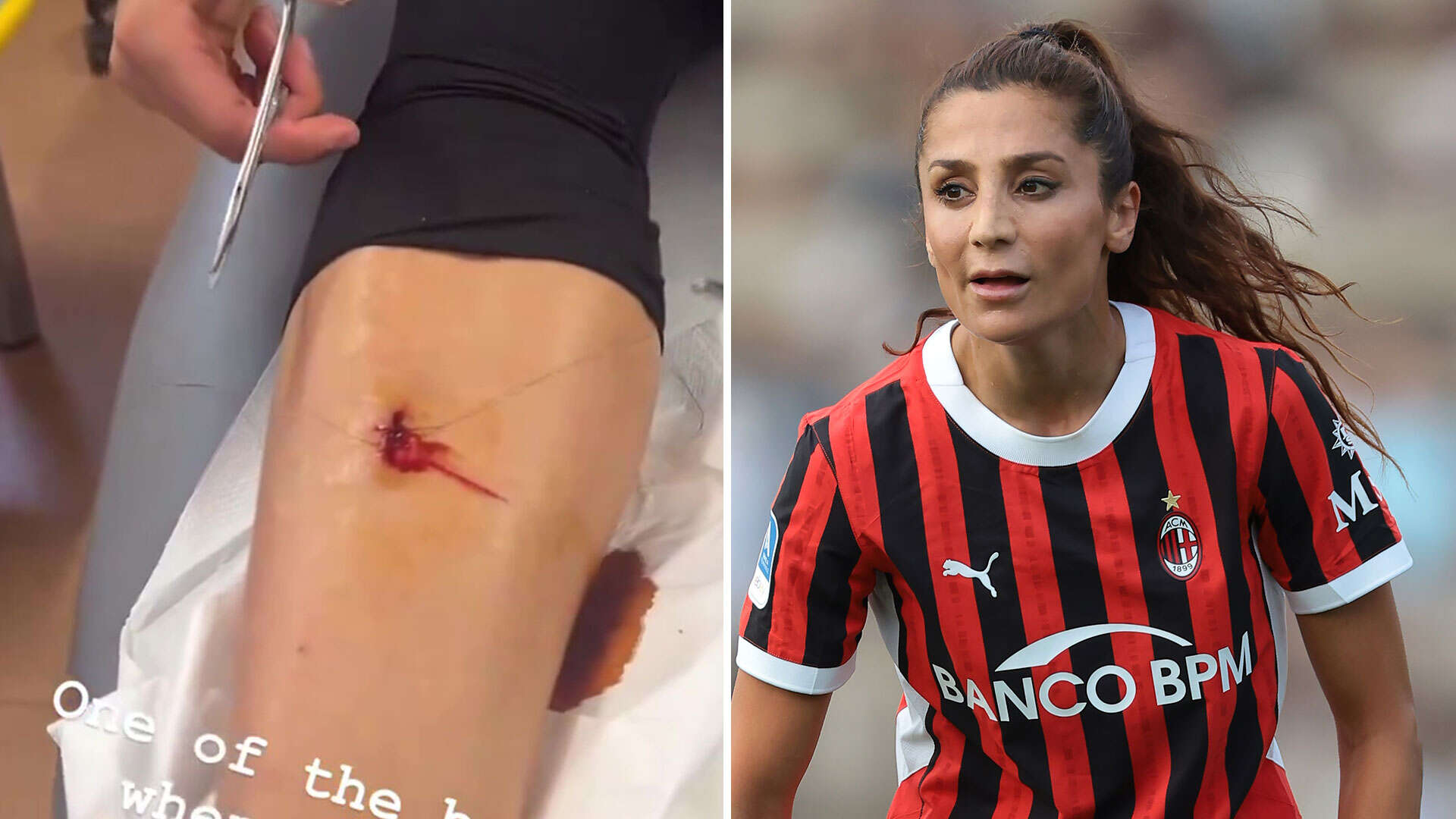 Watch AC Milan star stitch up own gory wound thanks to side hustle as a doctor