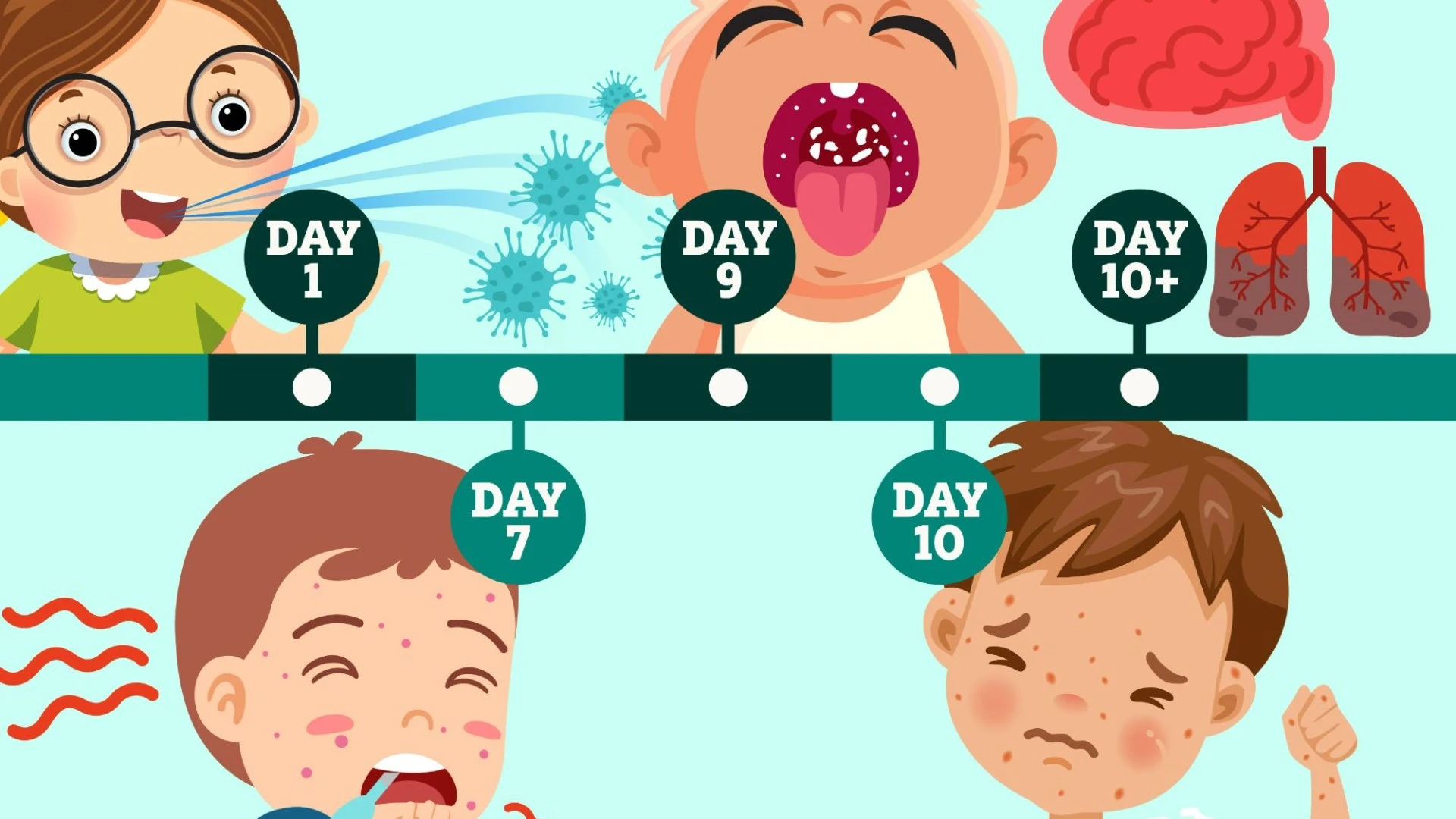Measles timeline revealed - all symptoms of the disease after child dies in UK