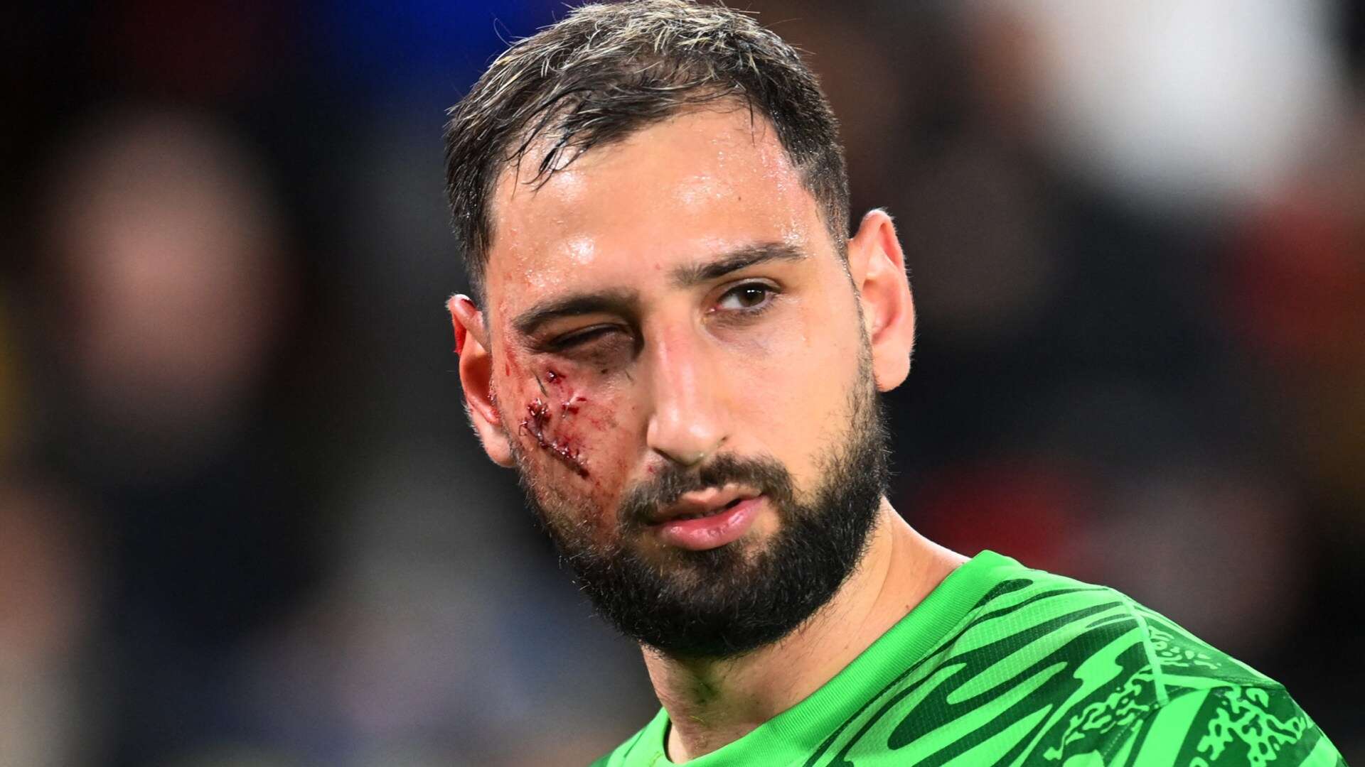 Donnarumma update as full extent of PSG star's gruesome injuries revealed