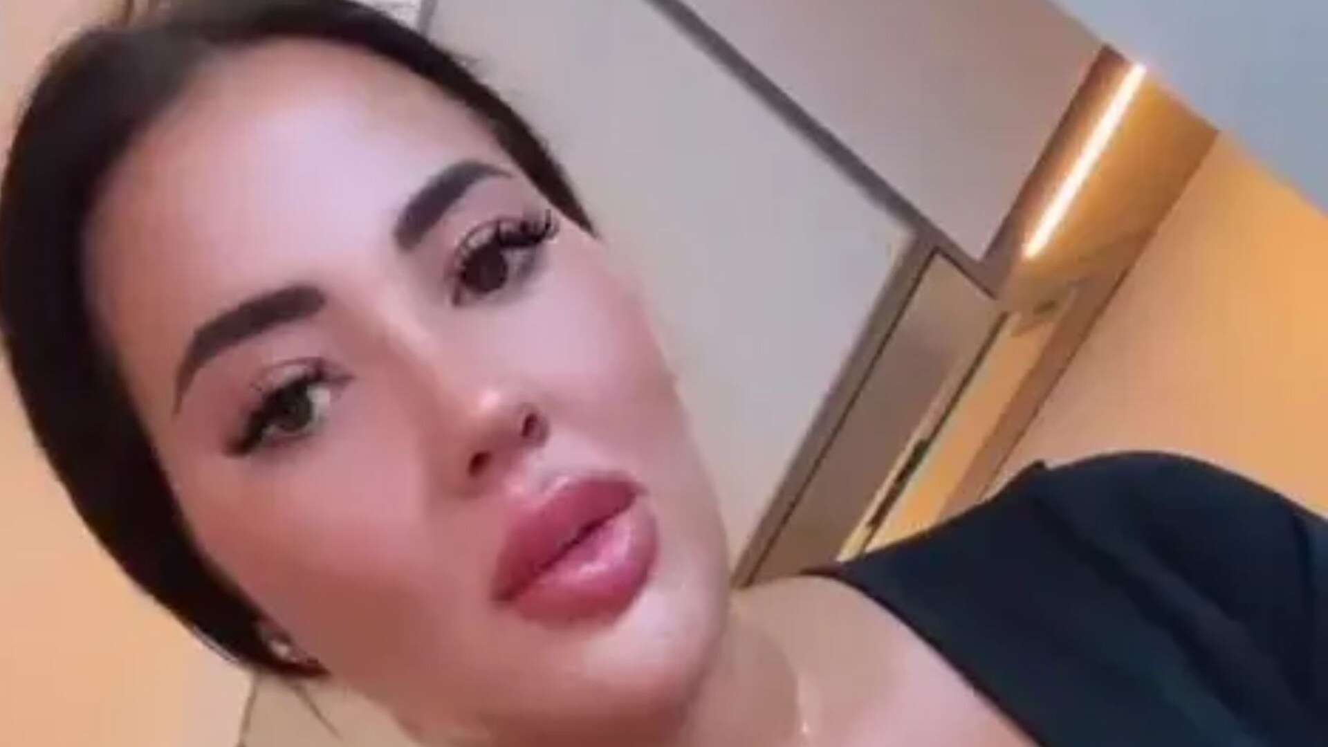 Towie star Yazmin Oukhellou dissolves 10 years of filler from face