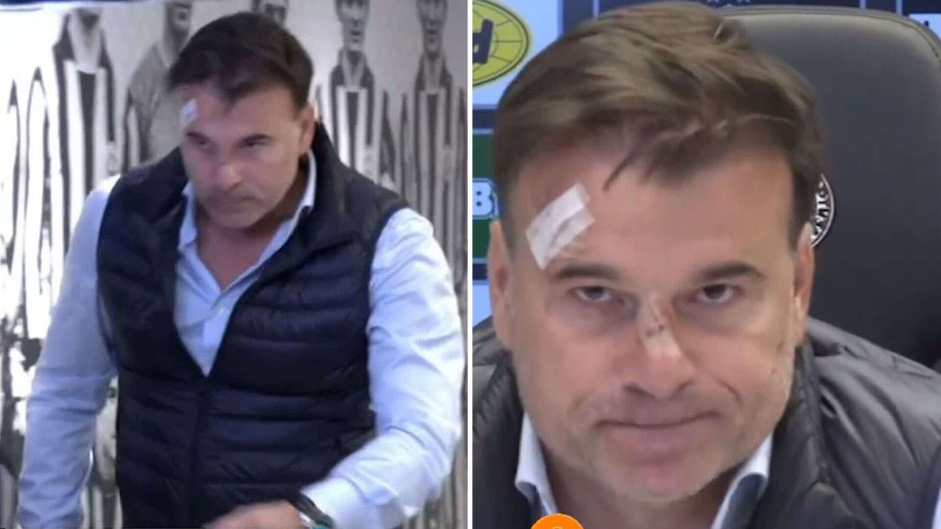 Footie boss attends presser with face slashed after raging fans smash window