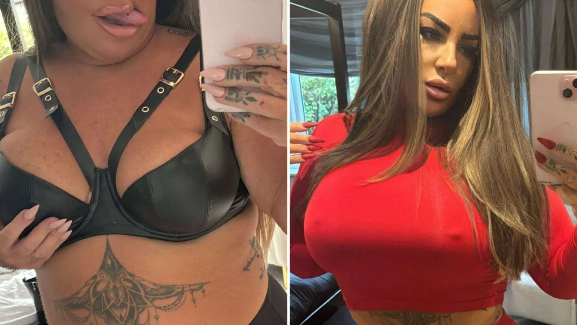 I nearly died from 'botched' Turkey boob job 3 times & lost quarter of my nipple