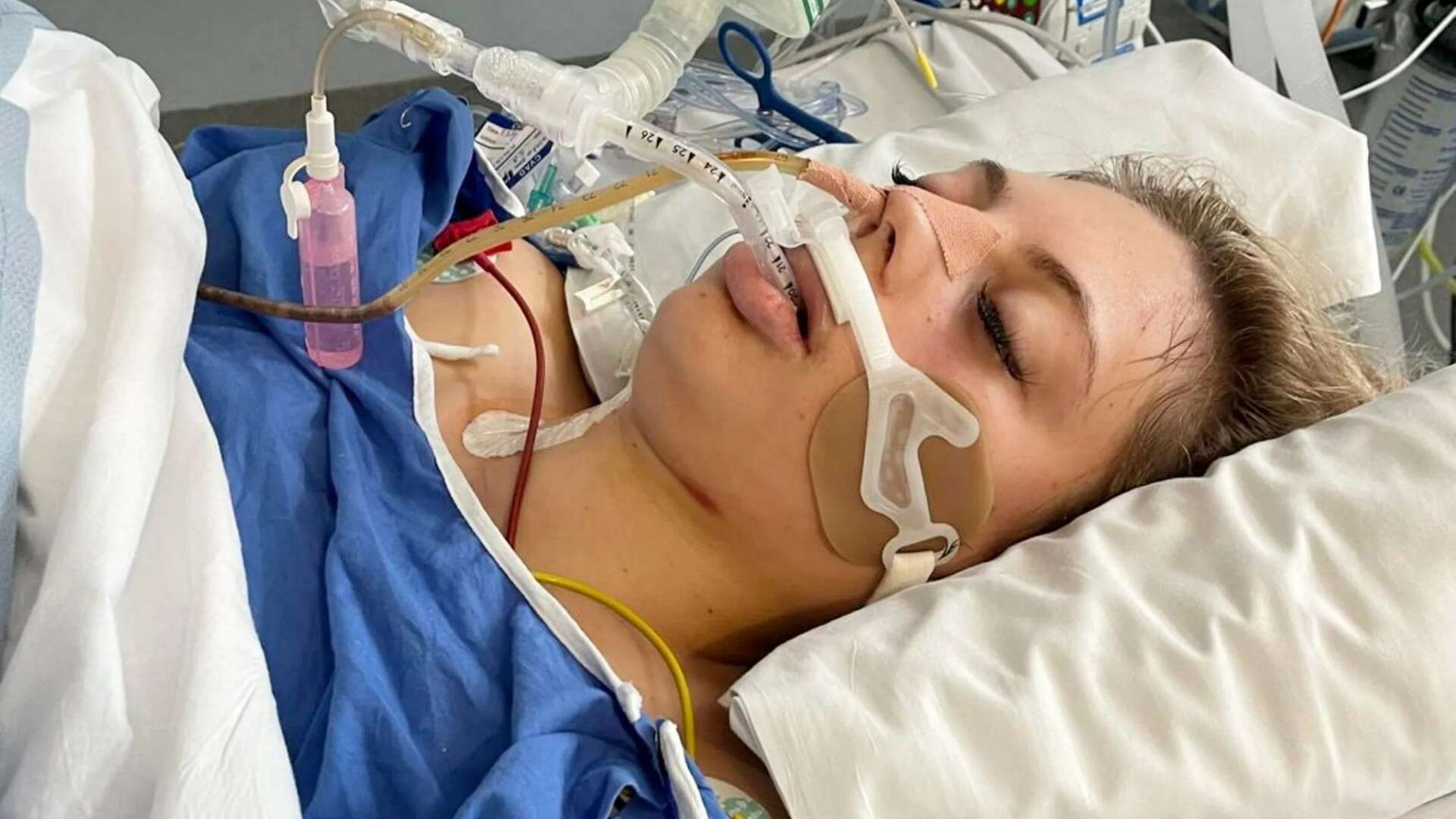 Family shares photo of student nurse left fighting for life in hit-&-run crash