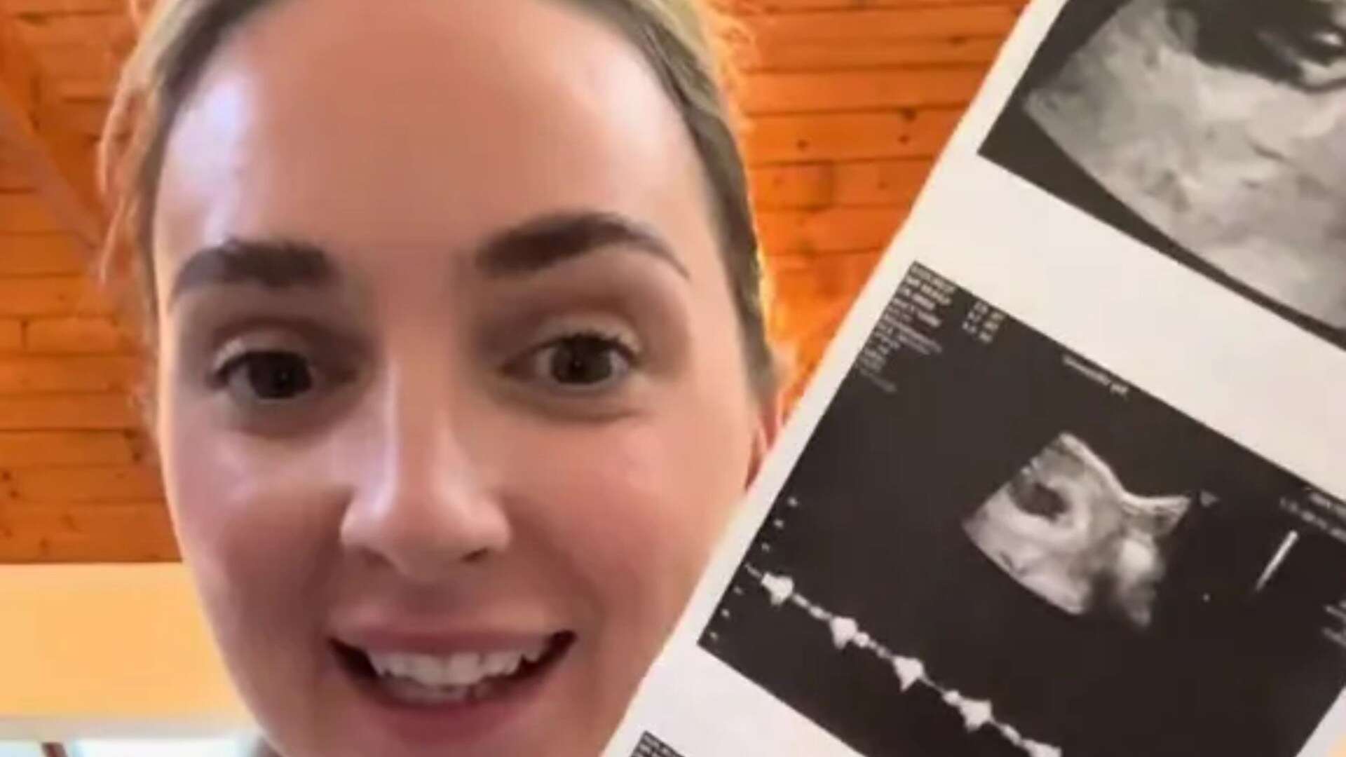 'Nervous’ Chloe Radford shows first baby scan & reveals how far along she is