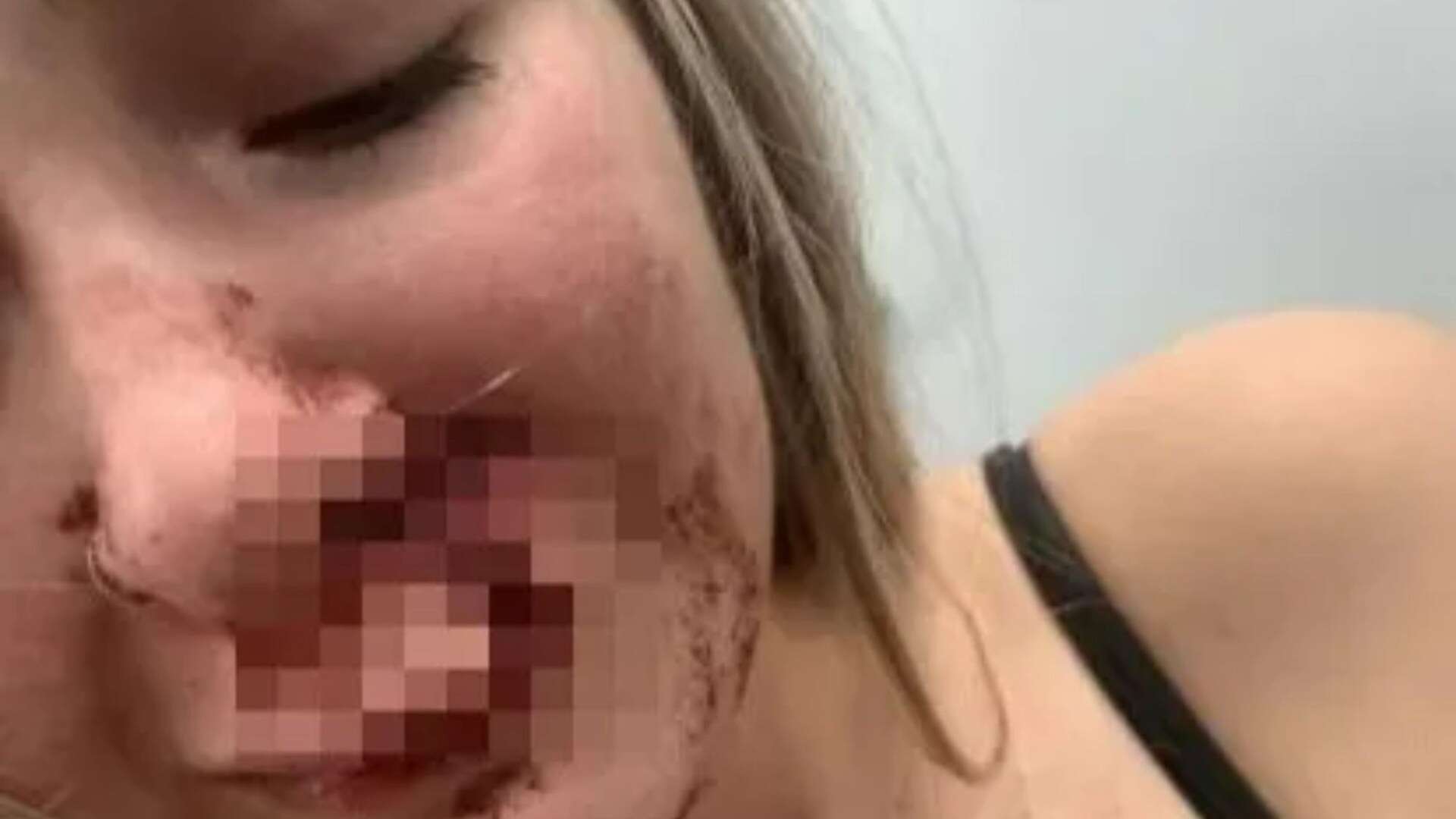 Teen girl's FACE 'bitten off' by stranger on bus in horror 5-minute attack