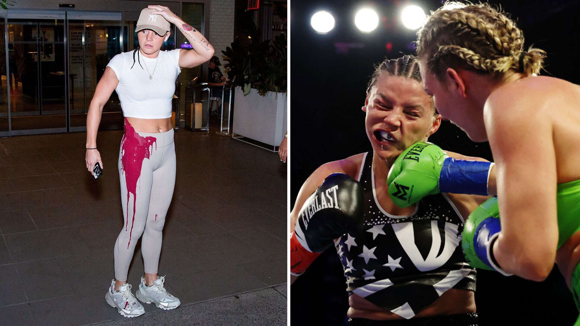 British boxer victim of 'hit-and-run' PAINT attack before losing title fight