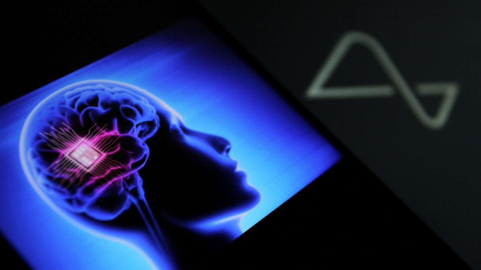 Musk teases huge update on Neuralink brain implant patient leaving people shocked