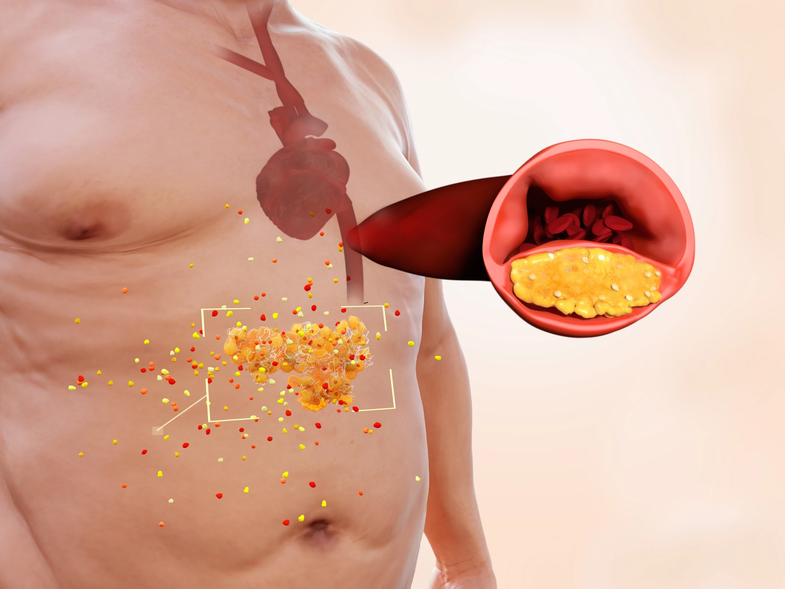 Nie udaje ci się obniżyć poziomu cholesterolu? Wypróbuj tych 5 sposobów niezwiązanych z dietą