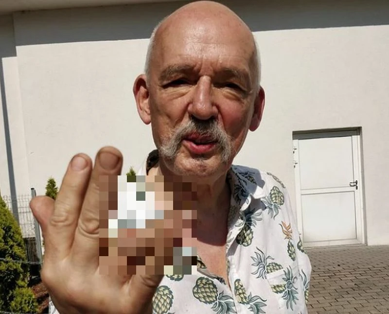Janusz Korwin-Mikke zaliczył bolesną kontuzję. Pokazał drastyczne zdjęcia