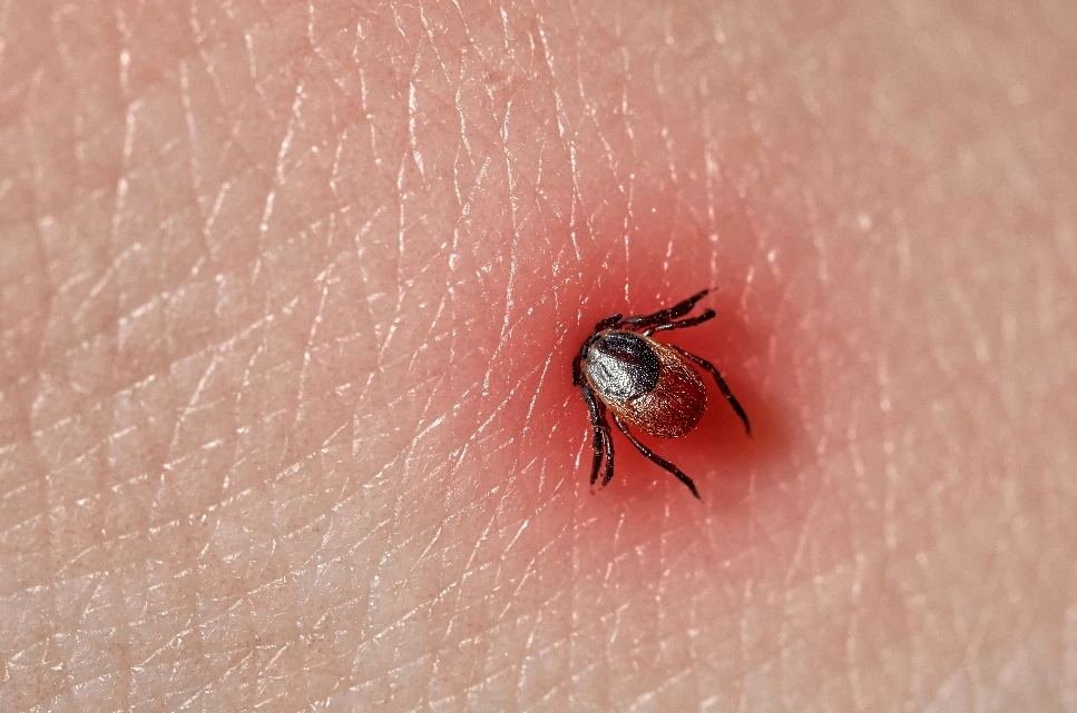 Uwaga na kleszcze! Bezpłatne badania na obecność krętków boreliozy na UW