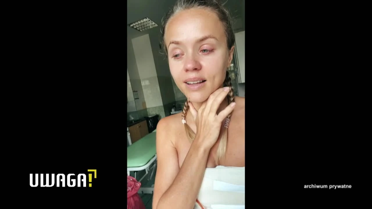 Uwaga! TVN: Oszpecone i zmuszane do amputacji. Kobiety przeżywają dramat po tych zabiegach