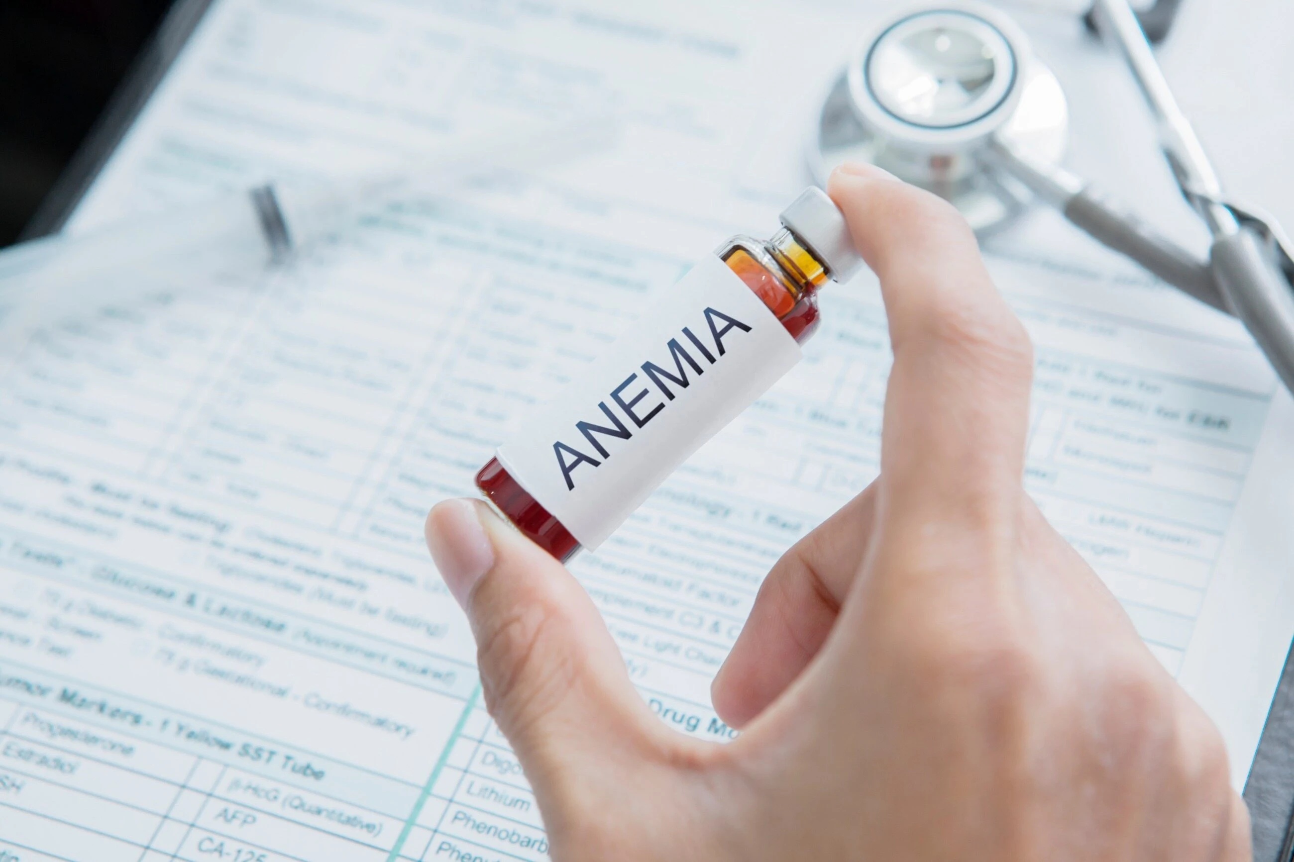 Anemia sierpowata u dzieci – co powinien wiedzieć rodzic?