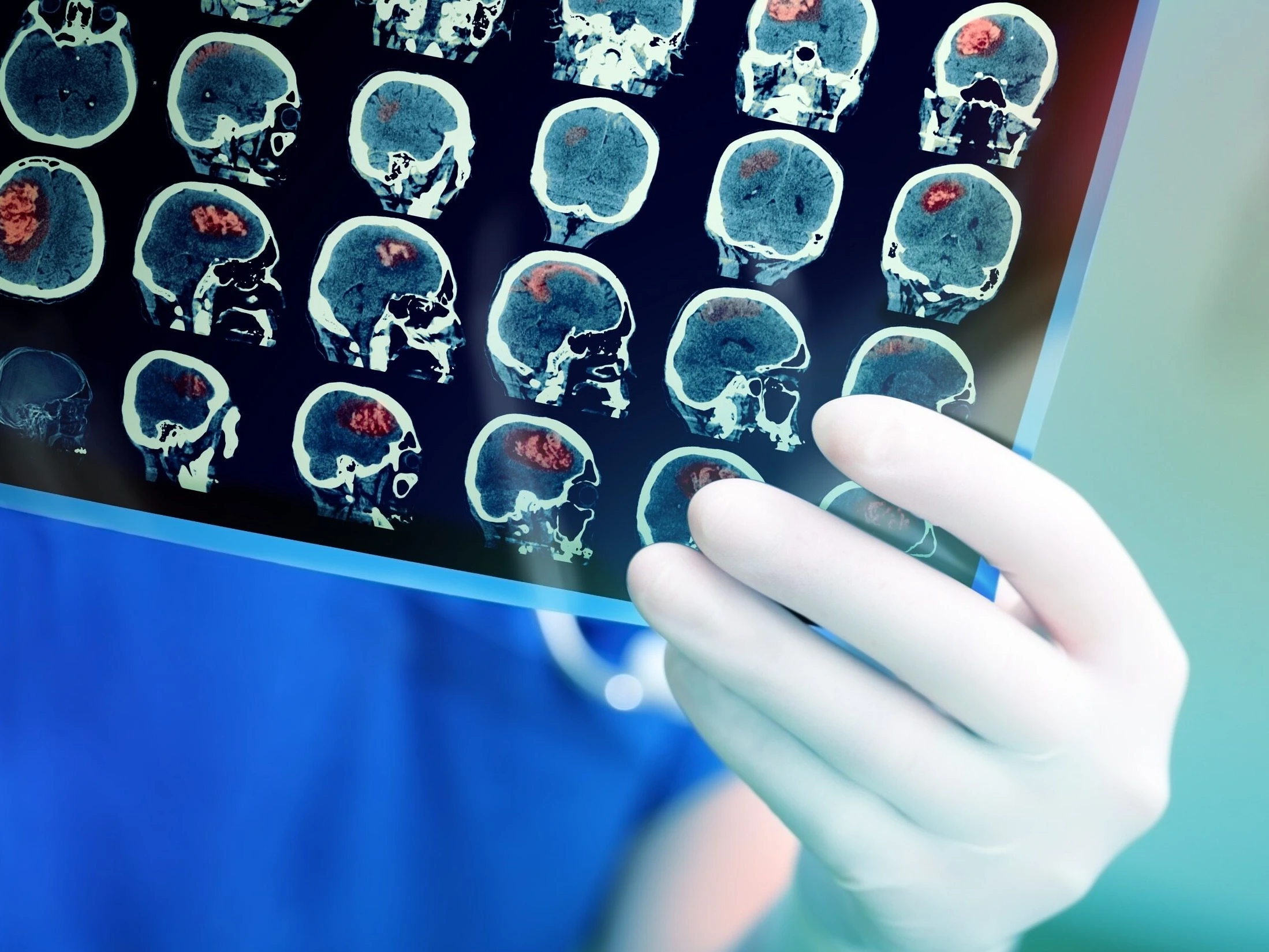 Dzieci z tą diagnozą nie przeżywają roku. Trwają badania nad nowymi terapiami
