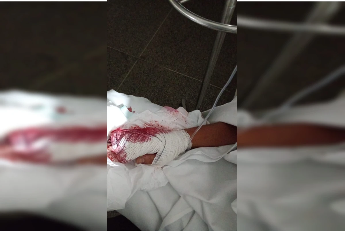 Jovem que teve corte profundo na mão aguarda atendimento há 6 dias